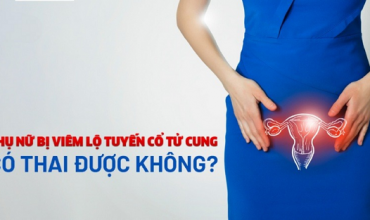 viem-lo-tuyen-co-pha-thai-duoc-khong